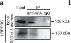 ヒナノビア Torao Mido/Puchinana - The English IDOLiSH7 Wiki