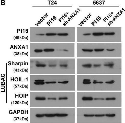 Fig.6.B showing Western Blotting from the publication: Peptidase inhibitor (PI16) impairs bladder cancer metastasis by inhibiting NF-κB activation via disrupting multiple-site ubiquitination of NEMO.