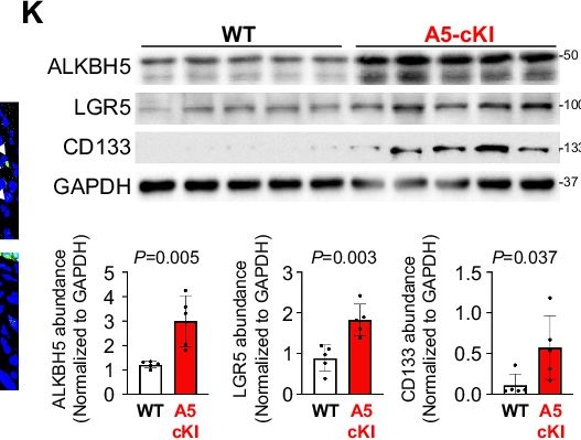 Fig.1.K showing Western Blotting from the publication: Targeting of the m6A eraser ALKBH5 suppresses stemness and chemoresistance of colorectal cancer.
