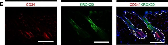 Fig.1.E showing Immunohistochemistry-immunofluorescence in a Mus musculus (House mouse) sample from the publication: Transcription factor KROX20 marks epithelial stem cell ancestors for hair follicle formation.