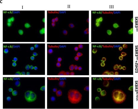 Fig.2.C showing Immunocytochemistry-immunofluorescence from the publication: KCTD15 deregulation is associated with alterations of the NF-κB signaling in both pathological and physiological model systems.