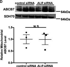 Fig.4.D showing Western Blotting from the publication: Augmenter of liver regeneration regulates cellular iron homeostasis by modulating mitochondrial transport of ATP-binding cassette B8.