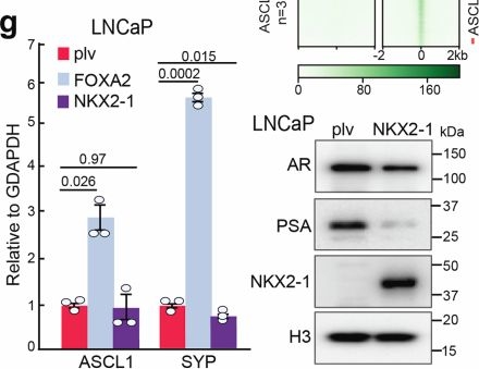 Fig.7.G showing Western Blotting in a Homo sapiens (Human) sample from the publication: NKX2-1 drives neuroendocrine transdifferentiation of prostate cancer via epigenetic and 3D chromatin remodeling.