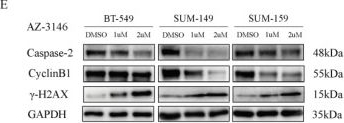 Fig.6.E showing Western Blotting in a Homo sapiens (Human) sample from the publication: NFYA-Mediated TTK Up-Regulation Drives Fast Cell Cycle Progression and Its Inhibition Leads to Mitotic Catastrophe in Triple Negative Breast Cancer.