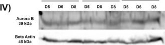 Fig.3.V showing Western Blotting in a Mus musculus (House mouse) sample from the publication: Age-Dependent Alterations of Chromosomal Passenger Complex Members During Implantation and Decidualization in the Mouse Uterus.