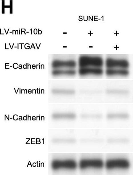 Fig.4.H showing Western Blotting from the publication: Downregulation of miR-10b-3p by EBV promotes tumor growth and metastasis via ITGAV in nasopharyngeal carcinoma.