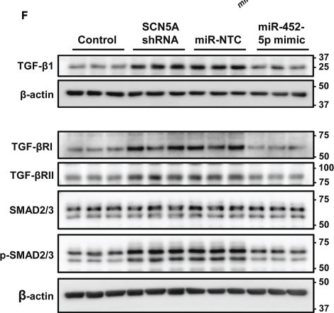 Fig.3.F showing Western Blotting in a Canis lupus familiaris (Domestic dog) sample from the publication: MicroRNA-452-5p regulates fibrogenesis via targeting TGF-β/SMAD4 axis in SCN5A-knockdown human cardiac fibroblasts.