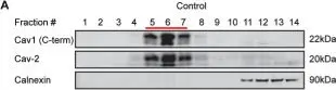 Fig.10.A showing Western Blotting from the publication: Tagging strategies strongly affect the fate of overexpressed caveolin-1.