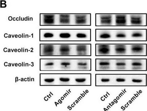 Fig.4.B showing Western Blotting from the publication: Ligustrazine Alleviates Blood-Brain Barrier Damage by Downregulating Expression of miR-297c-5p.