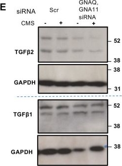Fig.8.E showing Western Blotting in a Homo sapiens (Human) sample from the publication: Stretch regulates alveologenesis and homeostasis via mesenchymal Gαq/11-mediated TGFβ2 activation.