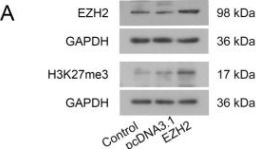 Tri-Methyl-Histone H3 (Lys27) (C36B11) Rabbit Monoclonal Antibody