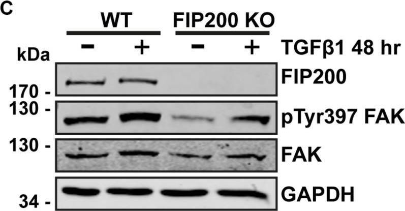 Fig.5.C showing Western Blotting in a Homo sapiens (Human) sample from the publication: Loss of the Essential Autophagy Regulators FIP200 or Atg5 Leads to Distinct Effects on Focal Adhesion Composition and Organization.