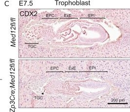 Fig.2.C showing Immunohistochemistry in a Mus musculus (House mouse) sample from the publication: Maternal Med12 safeguards trophoblast pluripotency and placental development.