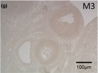 Fig.2.G showing Immunohistochemistry from the publication: Muscarinic receptors in the rat ovary are involved in follicular development but not in steroid secretion.