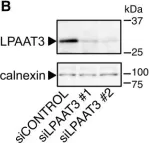 Fig.4.B showing Western Blotting in a Mus musculus (House mouse) sample from the publication: LPAAT3 incorporates docosahexaenoic acid into skeletal muscle cell membranes and is upregulated by PPARδ activation.