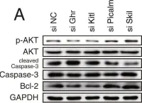 Fig.8.A showing Western Blotting from the publication: A novel system-level approach using RNA-sequencing data identifies miR-30-5p and miR-142a-5p as key regulators of apoptosis in myocardial infarction.