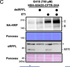 Fig.3.C showing Western Blotting from the publication: RFFL-mediated protein quality control limits functional rescue of TRID-CFTR modulator combination therapy for cystic fibrosis nonsense mutations.