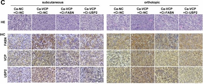 Fig.8.C showing Immunohistochemistry in a Homo sapiens (Human) sample from the publication: VCP enhances autophagy-related osteosarcoma progression by recruiting USP2 to inhibit ubiquitination and degradation of FASN.