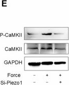 Fig.6.E showing Western Blotting in a Rattus norvegicus (Rat) sample from the publication: Mechanical sensing protein PIEZO1 controls osteoarthritis via glycolysis mediated mesenchymal stem cells-Th17 cells crosstalk.