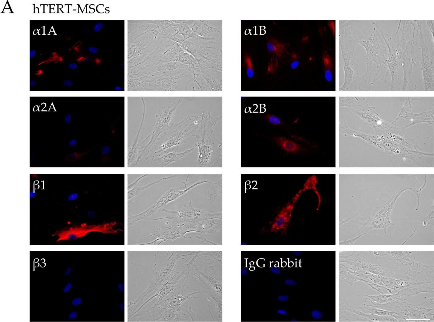 Fig.1.A showing Immunocytochemistry-immunofluorescence in a Homo sapiens (Human) sample from the publication: Noradrenaline Sensitivity Is Severely Impaired in Immortalized Adipose-Derived Mesenchymal Stem Cell Line.