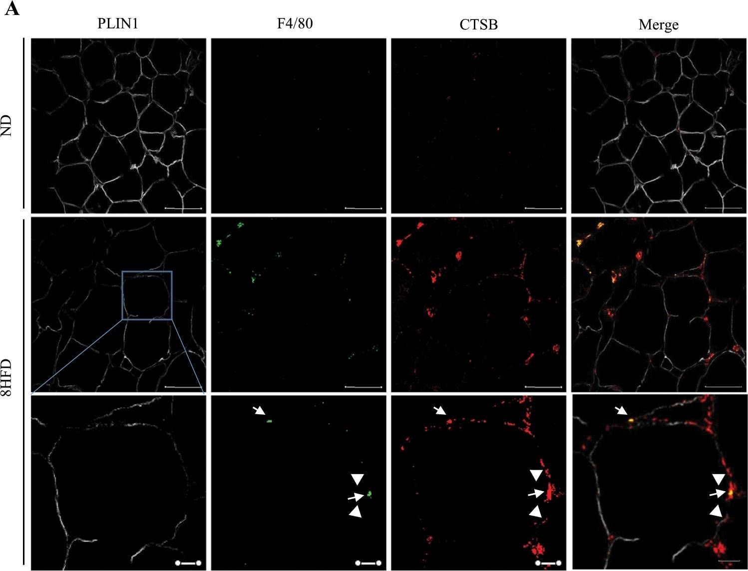 Cathepsin B overexpression induces degradation of perilipin 1 to cause lipid metabolism dysfunction in adipocytes.