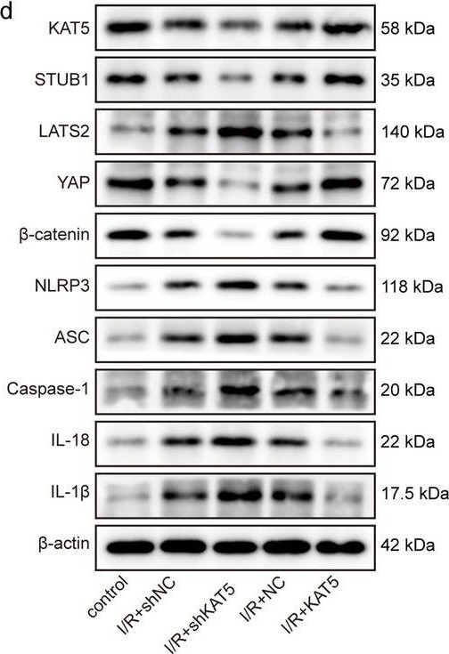 Fig.8.D showing Western Blotting in a Mus musculus (House mouse) sample from the publication: STUB1 is acetylated by KAT5 and alleviates myocardial ischemia-reperfusion injury through LATS2-YAP-β-catenin axis.