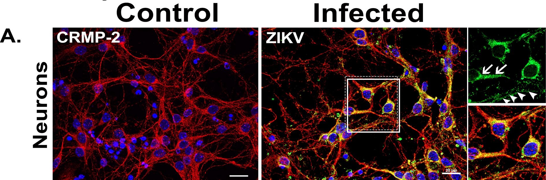 Fig.2.A showing Immunohistochemistry-immunofluorescence from the publication: Neural and endothelial cell-derived extracellular vesicles mediate Zika virus genome dissemination and productive infection in vivo.