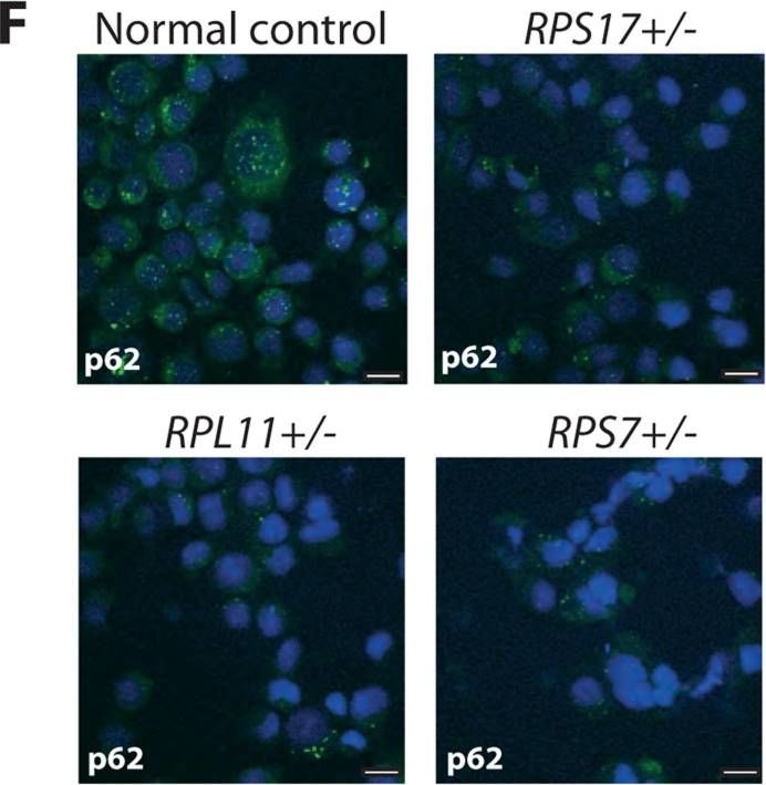 Ribosomal protein mutations induce autophagy through S6 kinase inhibition of the insulin pathway.