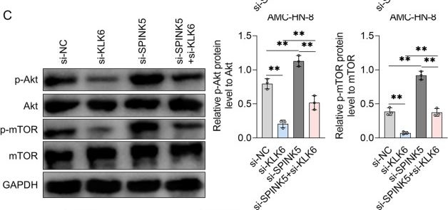 Fig.7.C showing Western Blotting from the publication: Downregulation of SPINK5 promotes laryngeal cancer cell malignancy through activation of KLK6-dependent glycolysis.