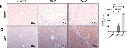 Fig.2.F showing Immunohistochemistry in an Equus caballus (Horse) sample from the publication: A rat model of cirrhosis with well-differentiated hepatocellular carcinoma induced by thioacetamide.