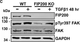 Fig.5.C showing Western Blotting in a Homo sapiens (Human) sample from the publication: Loss of the Essential Autophagy Regulators FIP200 or Atg5 Leads to Distinct Effects on Focal Adhesion Composition and Organization.