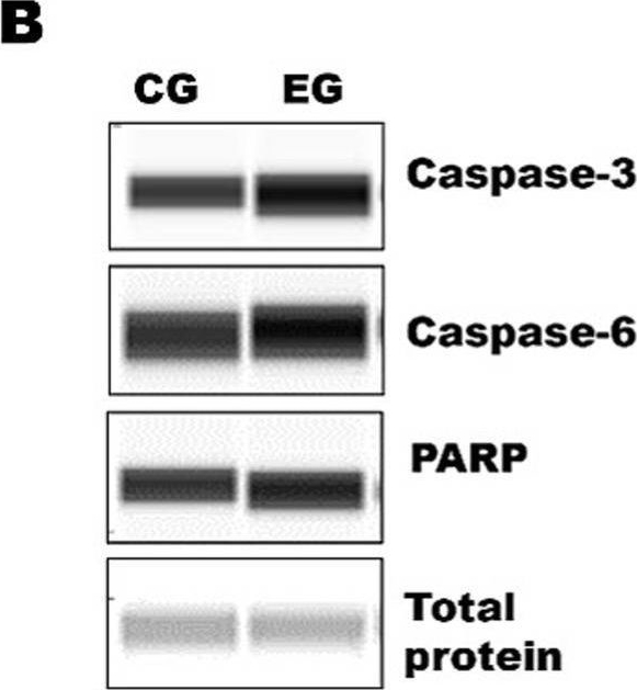 Fig.2.B showing Simple Western - Size in an Oryctolagus cuniculus (Rabbit) sample from the publication: Evaluation of autophagic and apoptotic markers during infection with animal virus causing hemorrhagic fever in rabbits.