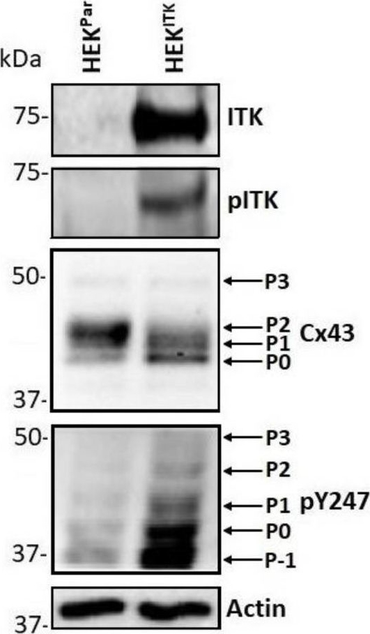 Fig.3.B showing Western Blotting in a Homo sapiens (Human) sample from the publication: Regulation of Cx43 Gap Junction Intercellular Communication by Bruton's Tyrosine Kinase and Interleukin-2-Inducible T-Cell Kinase.