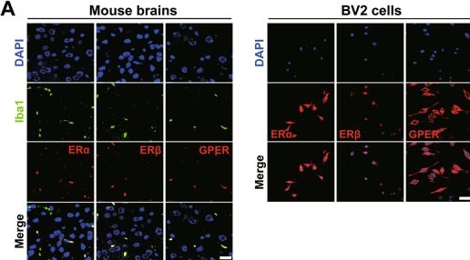 Fig.4.A showing Immunocytochemistry-immunofluorescence in a Mus musculus (House mouse) sample from the publication: Supraphysiologic doses of 17β-estradiol aggravate depression-like behaviors in ovariectomized mice possibly via regulating microglial responses and brain glycerophospholipid metabolism.