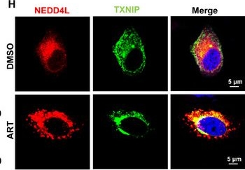 Fig.4.H showing Immunocytochemistry-immunofluorescence in a Homo sapiens (Human) sample from the publication: Artesunate Ameliorates APAP-induced Liver Injury by Promoting NEDD4L-Mediated Ubiquitination and Degradation of TXNIP.