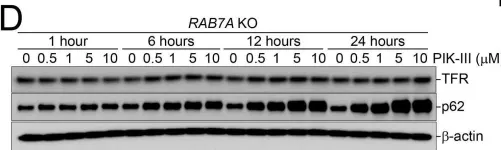 Fig.6.D showing Western Blotting from the publication: An iron-dependent metabolic vulnerability underlies VPS34-dependence in RKO cancer cells.