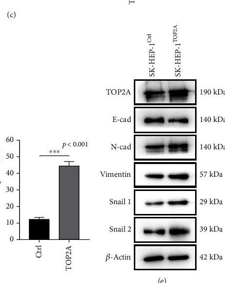 Fig.4.C showing Western Blotting from the publication: DNA Topoisomerase II-α Regulated by miR-22-5p Promotes Hepatocellular Carcinoma Invasion and Migration through the Hippo Pathway.