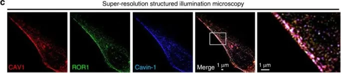 Fig.3.C showing Immunocytochemistry-immunofluorescence in a Homo sapiens (Human) sample from the publication: ROR1 sustains caveolae and survival signalling as a scaffold of cavin-1 and caveolin-1.