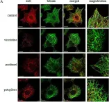Fig.2.A showing Immunocytochemistry-immunofluorescence from the publication: ROS-mediated EB1 phosphorylation through Akt/GSK3β pathway: implication in cancer cell response to microtubule-targeting agents.