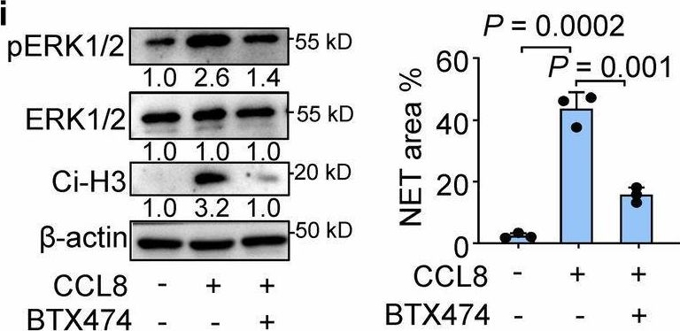 Fig.4.I showing Western Blotting in a Mus musculus (House mouse) sample from the publication: Breast cancer induces CD62L+ Kupffer cells via DMBT1 to promote neutrophil extracellular trap formation and liver metastasis.