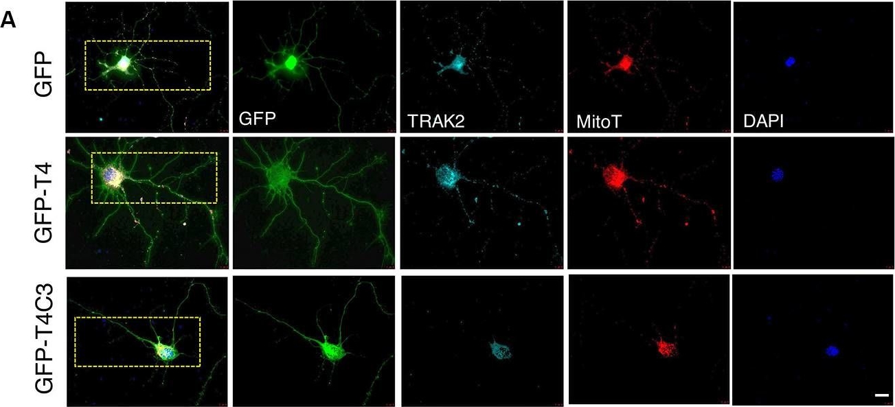 Fig.5.A showing Immunocytochemistry-immunofluorescence in a Mus musculus (House mouse) sample from the publication: Truncated Tau Induces Mitochondrial Transport Failure Through the Impairment of TRAK2 Protein and Bioenergetics Decline in Neuronal Cells.