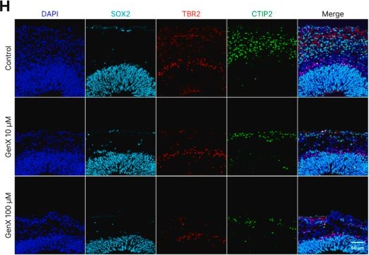 Fig.3.H showing Immunocytochemistry-immunofluorescence from the publication: GenX exposure induces neurodevelopmental impairment and synaptic toxicity in hESC-derived cerebral organoids.
