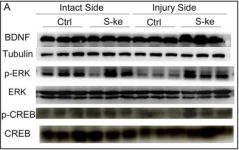 p44/42 MAPK (Erk1/2) (137F5) Rabbit mAb | Cell Signaling Technology