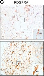 Fig.6.C showing Immunohistochemistry in a Mus musculus (House mouse) sample from the publication: Estrogen receptor-α ablation reverses muscle fibrosis and inguinal hernias.