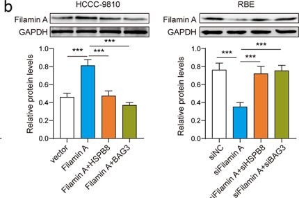 Fig.5.B showing Western Blotting from the publication: HSPB8-BAG3 chaperone complex modulates cell invasion in intrahepatic cholangiocarcinoma by regulating CASA-mediated Filamin A degradation.