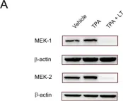 Fig.4.A showing Western Blotting from the publication: Dachshund Homolog 1: Unveiling Its Potential Role in Megakaryopoiesis and Bacillus anthracis Lethal Toxin-Induced Thrombocytopenia.