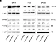 Fig.3.C showing Western Blotting from the publication: Convergence of miR-143 overexpression, oxidative stress and cell death in HCT116 human colon cancer cells.
