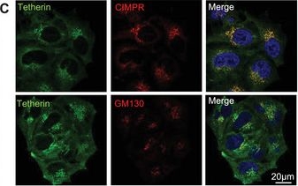 Fig.1.C showing Immunocytochemistry-immunofluorescence in a Homo sapiens (Human) sample from the publication: Exosome Tethering Requires Tetherin Homodimerisation.
