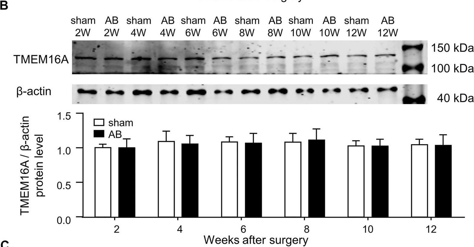 Fig.1.B showing Western Blotting in a Mus musculus (House mouse) sample from the publication: TMEM16A Plays an Insignificant Role in Myocardium Remodeling but May Promote Angiogenesis of Heart During Pressure-overload.
