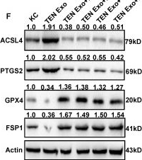 Fig.4.F showing Western Blotting in a Homo sapiens (Human) sample from the publication: Exosomal miR-375-3p mediated lipid metabolism, ferritinophagy and CoQ-dependent pathway contributes to the ferroptosis of keratinocyte in SJS/TEN.